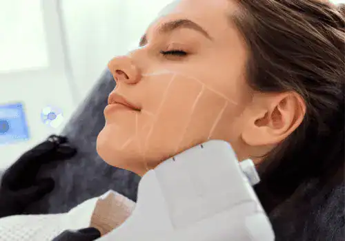 Woman receiving non-invasive HIFU treatment for jawline lift