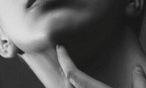 A model glowing after DoubleTite RF Microneedling consultation for non-surgical skin tightening in Melbourne.